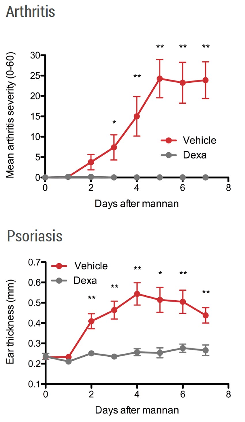 Diagram of arthritis and psoriasis